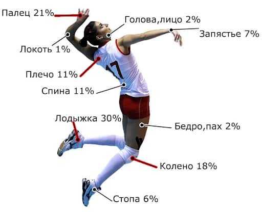 Бурсит коленного сустава у волейболистов - sportprotection