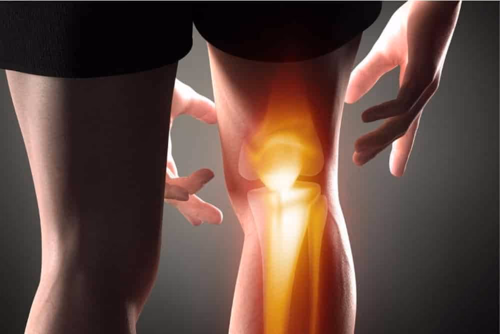 Мифы и правда об ревматоидном артрите