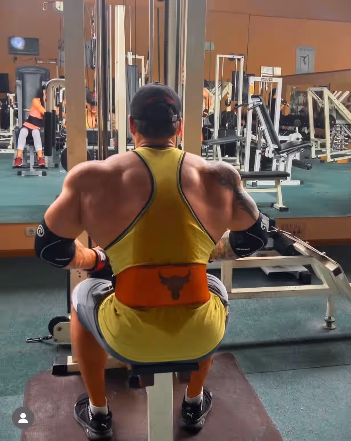 Налокітники після травми ліктя Rehband 7081 (5 мм)